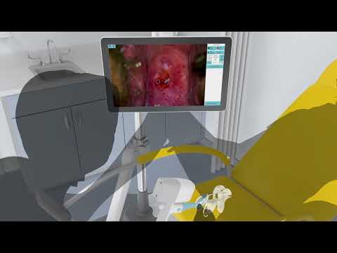 DYSIS Ultra | Animated Product Video