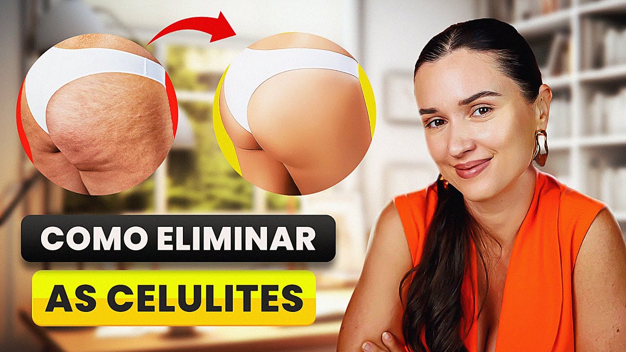 5 DICAS PARA ACABAR DE VEZ COM A CELULITE!
