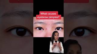 How to Prevent Pimples On The Eyebrows #shorts