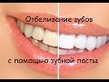 Отбеливание зубов / Разрушители мифов / Позитивная стоматология / SunSmileClinic ...