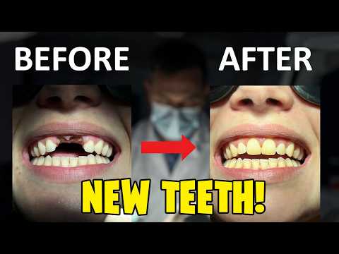 Tooth Regrowth Drug Explained | Japanese Human Trials of TRG‑035 (2025)