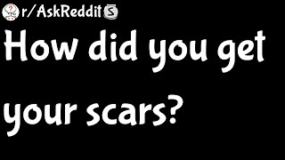 How did you get your scars (r/AskReddit)