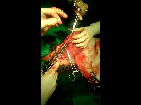 download lagu mp3 mp4 Dr Pradhan Dombivli, download lagu Dr Pradhan Dombivli gratis, unduh video klip Dr Pradhan Dombivli