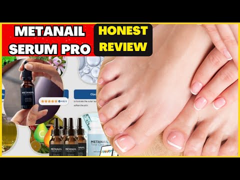 Metanail Complex Reviews 2026: The Best Nail Fungus Serum?