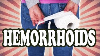 Everyone Has Hemorrhoids All the Time, Even You