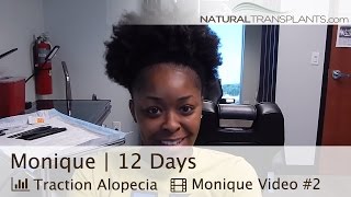 Traction Alopecia | Natural Hair Transplant | 12 Day Postop (Monique)
