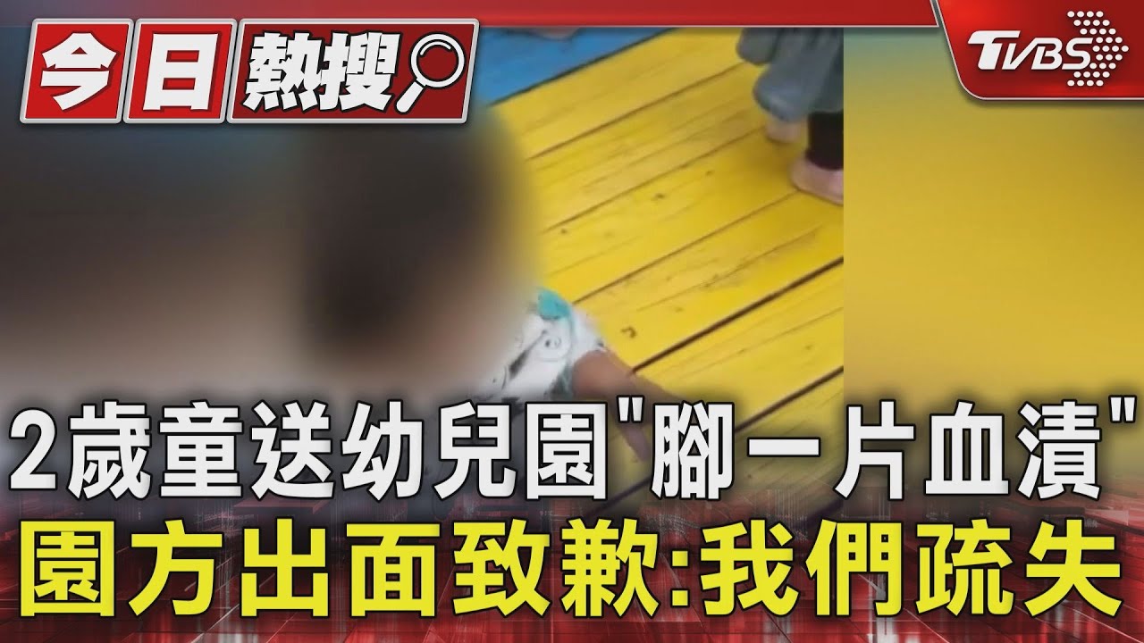 2歲童送幼兒園「腳一片血漬」! 園方出面致歉:我們疏失