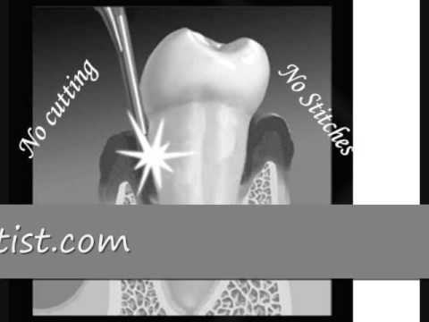 Laser Gum Periodontist 1 213 691 1234