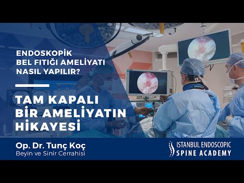 Tam kapalı boyun fıtığı ameliyatı nasıl yapılır?