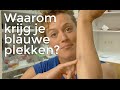 Waarom krijg je blauwe plekken?? | Het Klokhuis