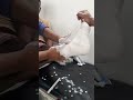Short Leg Full Plaster Shorts Ourtreatment Shortvideo Fracture