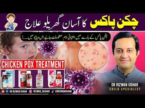 Effective chicken pox treatment🦠🤒: What you need to know #chickenpox #treatment
