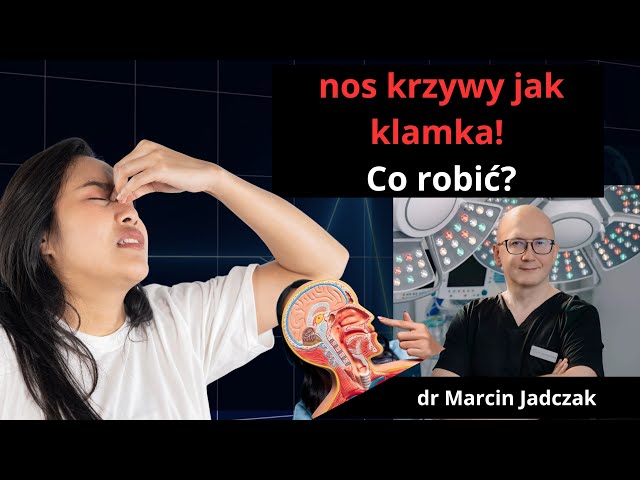 Dlaczego Twój nos jest krzywy Ekspert zdradza szokujące fakty! DR MARCIN JADCZAK