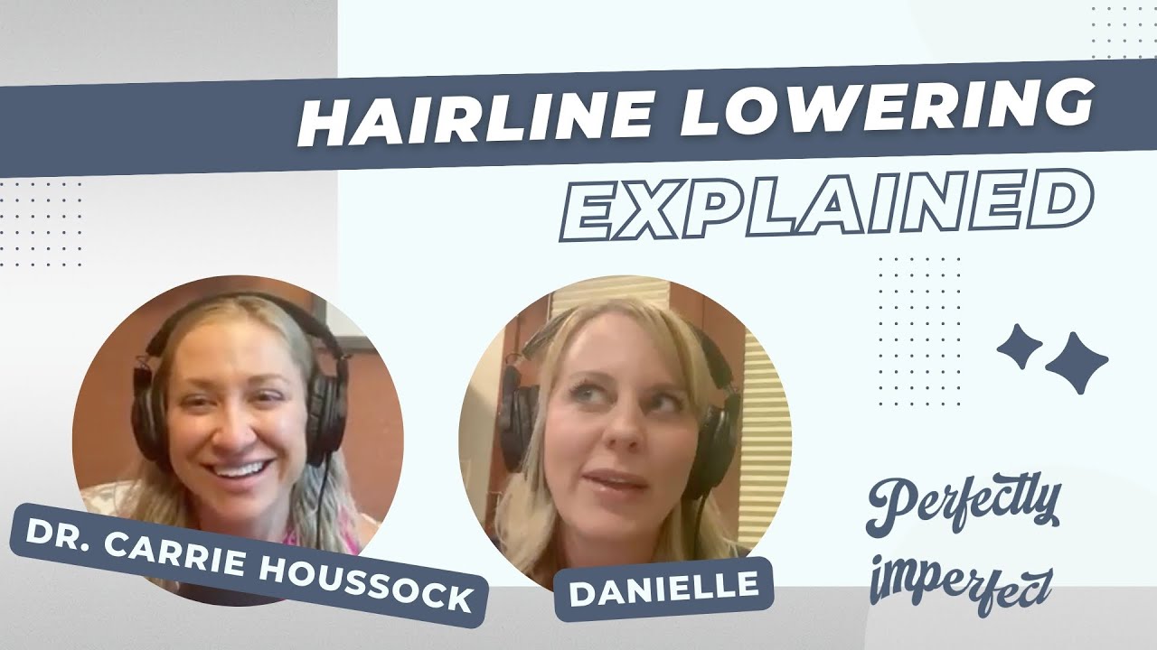 Hairline Lowering for Women Explained