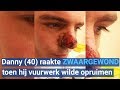 Danny (40) raakte zwaargewond toen hij vuurwerk wilde opruimen