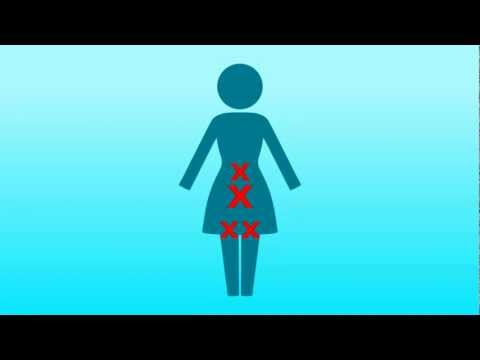 Pelvic Floor Muscles and Kegel Exercisors