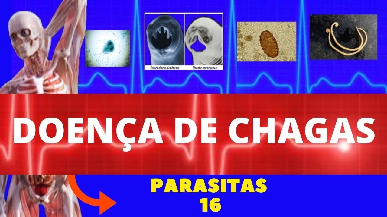 DOENÇA DE CHAGAS - TRYPANOSOMA CRUZI (BARBAEIRO) - PARASITOLOGIA | INFECTOLOGIA
