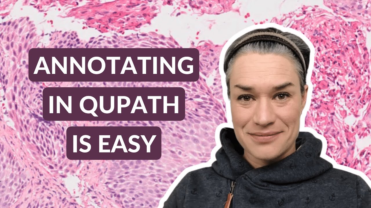 Pathology Image Annotations | QuPath annotation tutorial