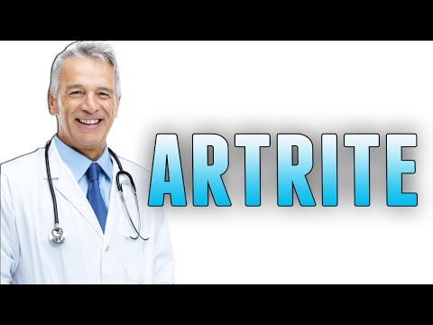Artrite medicamente articulare