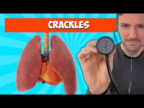 Fine and Coarse Crackles: Lung Sounds For Beginners 🔥🔥🔥