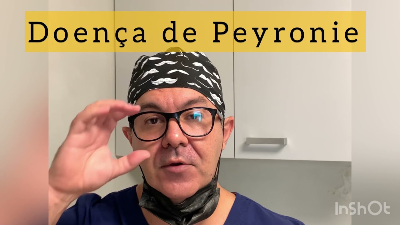 Leonardo De Souza Alves-79