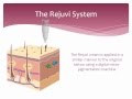 Tattoo Removal - Non laser - How it works - Rejuvi ...