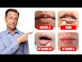 5 Things Your LIPS Can Tell You about Your Nutritional State