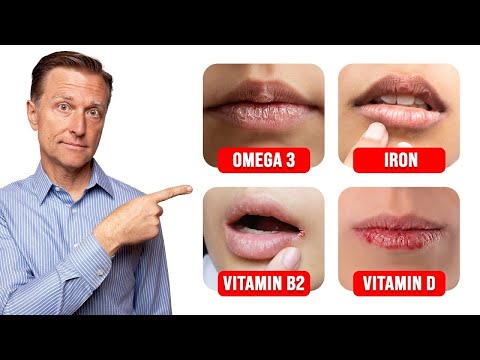 Weird Taste in Your Mouth 9 Causes