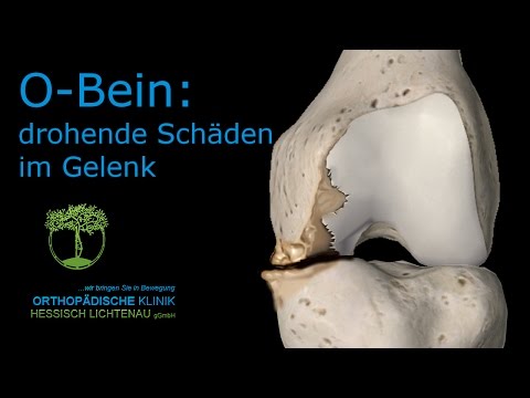 Die Geheimnisse des Knöchels und des Fußes online lesen Behandlung des Vorstehens der Halswirbelsäule in Ufa