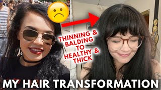 THIN TO THICK HAIR TRANSFORMATION! Thick & Healthy Hair Tips