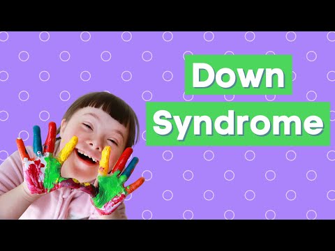 Down Syndrome: Genetics, Symptoms, and Life Long Movement | Trisomy 21