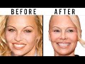 Has Pamela Anderson Had Plastic Surgery Plastic Surgery Analysis