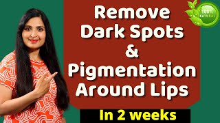 How To REMOVE Pigmentation / Dark Spots AROUND MOUTH Fast (HOME DIY) /  Dark Spots Treatment #beauty