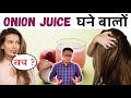 ONION Juice For Hair Growth Hindi Dr Supratim Saha