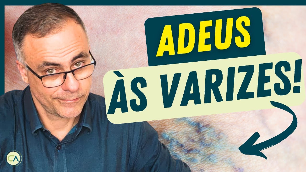 MELHOR SUPLEMENTO DO MUNDO PARA VARIZES: Picnogenol