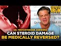 Dr. Testosterone Answers: Is It Possible To Undo Damage Caused By Steroid Use?