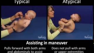 So sánh trẻ bình thường và bất thường: 4 tháng tuổi