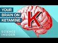 What Ketamine Actually Does To Your Brain Insider Science