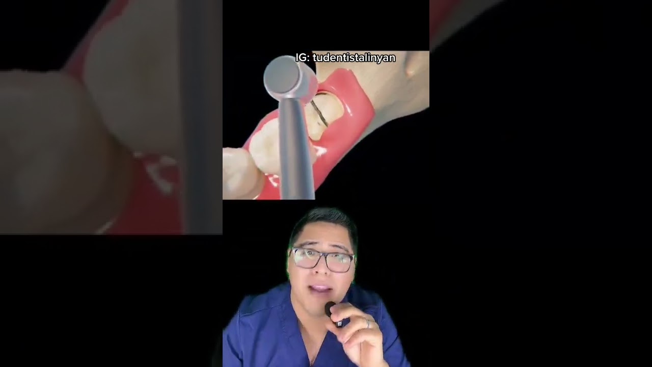 mira cómo TUS MUELAS DEL JUICIO dolerán 😱