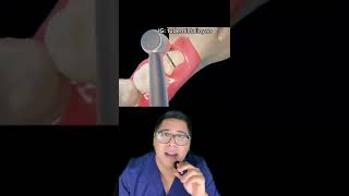 mira cómo TUS MUELAS DEL JUICIO dolerán 😱