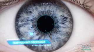 1 Day ACUVUE®‎ Moist Brand Contact Lenses Multifocal
