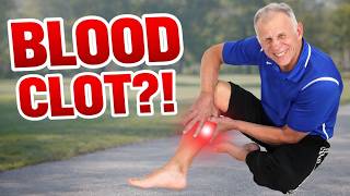 Is Your Calf Pain a Blood Clot? Try This Simple Test!