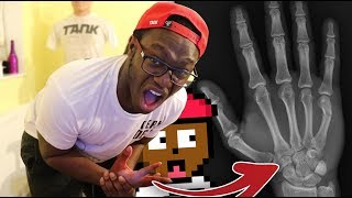DON&#39;T PLAY THIS! (I BROKE MY HAND)