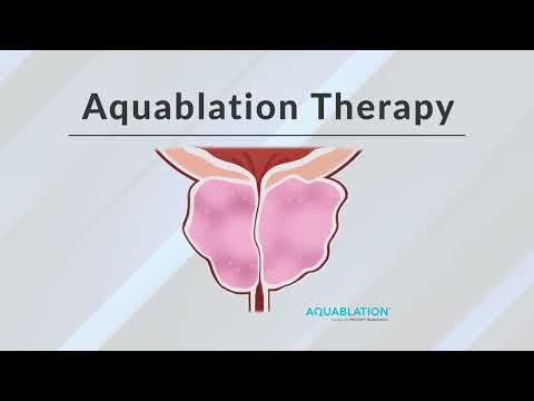 What is Aquablation Therapy?