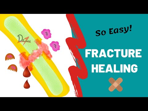 Fracture Healing | PRIMARY & SECONDARY