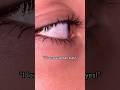 I’ve heard “Omg wait are your eyes two different colors!?” Way too many times￼💀#heterochromia #eyes