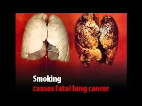 skutki palenia papierosów