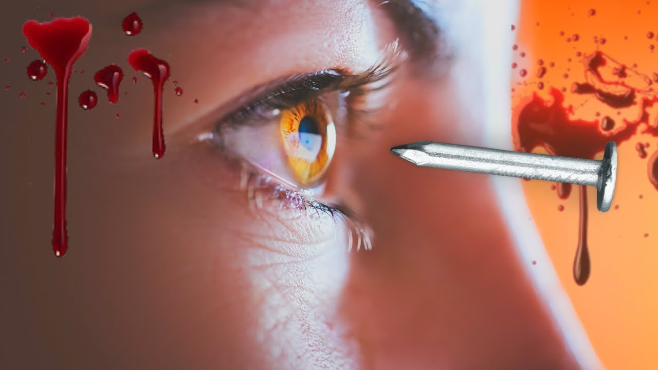 PERFURAÇÃO OCULAR - Como Tratar Ferimento nos Olhos.