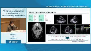 제2회 아산·세브란스 <b>폐</b>고혈압 공동 심포지엄 PH Academy 2022 : PAH target agents and liver transplantation in portopulmonary hypertension 미리보기 썸네일