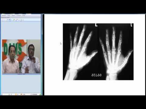 #RadioPath Series 5 (#Maffucci Syndrome) #USMLE #NEETPG #DAMS